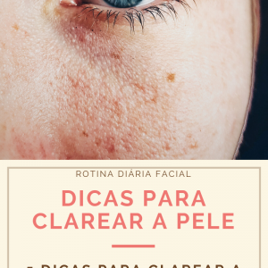 5 Dicas Rápidas para clarear a pele do rosto