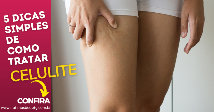 5 dicas simples de como tratar celulite
